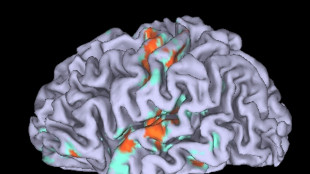 Le difficolt&agrave; economiche fanno invecchiare prima il cervello