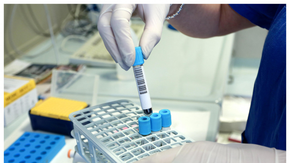 Autismo, verso la diagnosi precoce da una goccia di sangue
