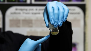 Une &eacute;tude &eacute;tablit un lien entre bisexualit&eacute; et certains &eacute;l&eacute;ments g&eacute;n&eacute;tiques