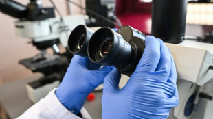 Rep&eacute;rer Alzheimer par une prise de sang: une r&eacute;volution, mais pour quoi faire ?