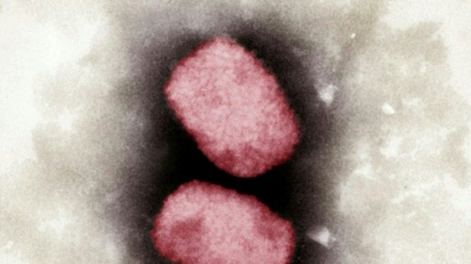 Mit Affenpocken Infizierte sollen f&uuml;r 21 Tage in Isolation