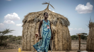 Rare bone-eroding disease ruining lives in Kenya's poorest county