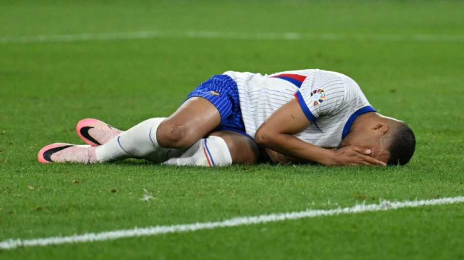 Com fratura no nariz, Mbapp&eacute; 'segue sendo d&uacute;vida' contra a Holanda