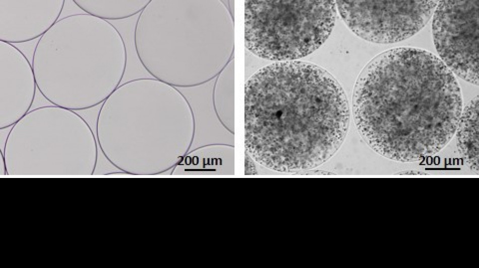 Distrofia muscolare, il 20 giugno 'M'illumino di arancione'