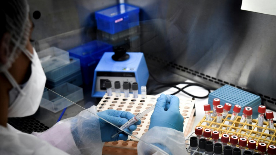 Sant&eacute;: gr&egrave;ve massive des biologistes, le gouvernement maintient sa ponction