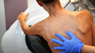 Cancers du sein, colorectal, du col de l'ut&eacute;rus: mettre les bouch&eacute;es doubles pour d&eacute;pister en France